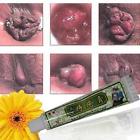693594323664 Unbranded Hemorrhoids Ointment External Treatment Cream With Tubes