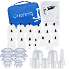 712038309399 Cupping Warehouse Ultimate Cup Chinese Polycarbonate Therapy Set