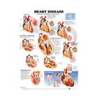7225-parent Anatomical Chart Company Heart