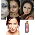 735786016401 Auravedic Face Oil Pimples Acne
