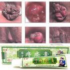 745272236893 Unbranded Hemorrhoids Ointment External Treatment Cream With Tubes