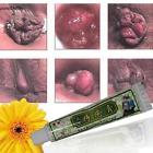 747529670092 Unbranded Hemorrhoids Ointment External Treatment Cream With Tubes
