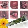 748389597000 Unbranded Hemorrhoids Ointment External Treatment Cream With Tubes