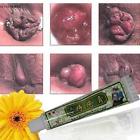 756353727971 Unbranded Hemorrhoids Ointment External Treatment Cream With Tubes