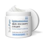 784672945226 Truly Pure Company Psoriasis Eczema Cream Organic Advanced