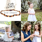B07bnbn3y2 Lolly Llama Raw Amber Teething Necklace For Babies Unisex Pain