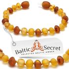 Bbr1452lhubrqus0229 Raw Teethers Amber Teething Bracelet Or Anklet Certified Beads Higher