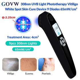 Pd02b65 Govw 65mw/cm2 308nm Excimer Uvb Phototherapy Light Treatment For Skin Diseases Device