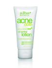 N-a Alba Botanica Acnedote Oil Control Lotion Ounce 885563143292
