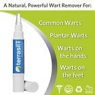 Wx7dqasqa2 Aidance Skincare Topical Solutions Terrasil Wart Removal Stick 882982424513