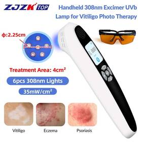 Pd02w35 Zjzktop 308nm Narrowband Lamp Targeted Uvb Treatment For Eczema Skin Disorders 35mw/cm