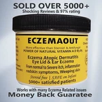 All Natural Dyshidrotic Eczema Cream Non Steroid. Fixed Price $17.00.