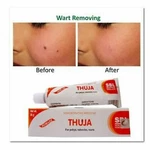 Sbl Thuja Homeopathic Cream 25 Gm Warts, Polypus, Corns, Brown Spots (pack Of 3). Fixed Price $14.03.