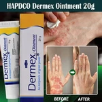 Psoriasis Eczema Cream Organic Dermatitis Antifungal Treatment Itch Skin Balm. Fixed Price $17.88.