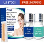 Remover And Repair Liquid Mole Corrector Wart Foot Corn Removal. Fixed Price $9.98.