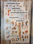 Set Of Vintage Anatomical Charts 11.25 X 14 Orthopaedic Hand Wrist Hip Knee. Fixed Price $25.00.