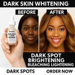 Derma Snow Dark Spot Lightener Serum Skin Whitening & Melasma Treatment. Fixed Price $54.99.