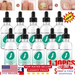 1-10PCS New Kerassentials Toenail Treatment Oil, For Us. Fixed Price $69.00.