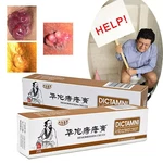 Hemorrhoids Remove Ointment Herbal Cream Relief Piles Pain Reduce Itching Sale. Fixed Price $10.37.