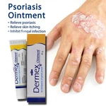 Psoriasis Eczema Cream Organic Dermatitis Antifungal Treatment Itch Skin Balm. Fixed Price $18.61.